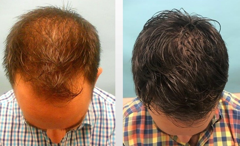 FoliPrime - Customer Happy